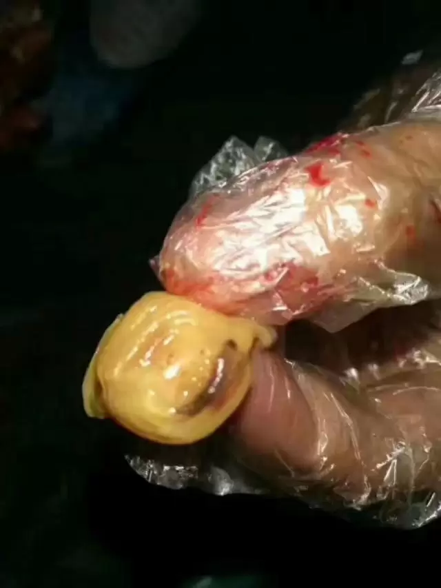 为什么要用开口药,用开口药的好处,来教你一招插图2 为什么要用开口药,用开口药的好处,来教你一招插图2
