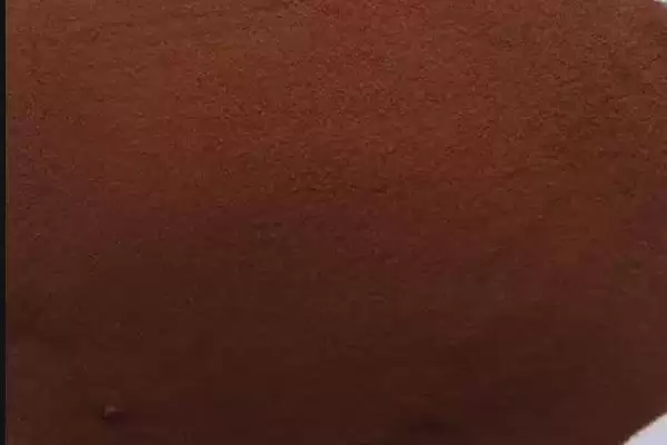 常见的铁肥有哪些种类和名称呢,常见的铁肥有哪些插图5 常见的铁肥有哪些种类和名称呢,常见的铁肥有哪些插图5