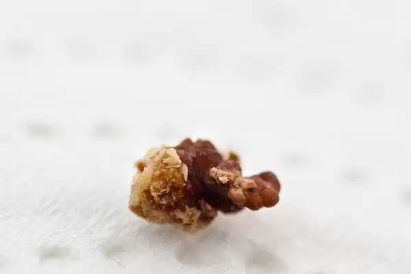 狗得了结石怎么解决,狗结石小且症状轻可药物治疗吗插图4