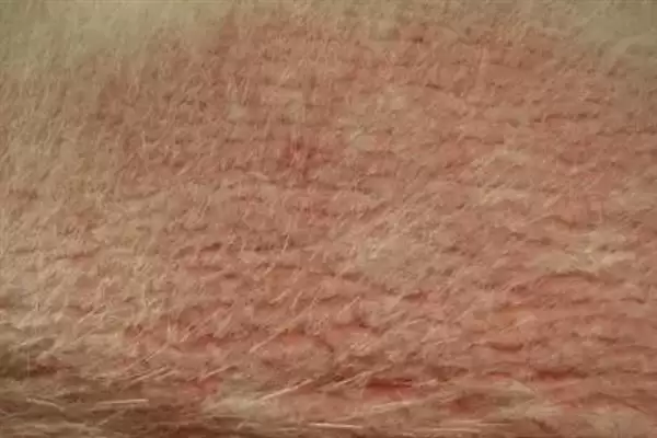 狗狗过敏性皮炎因何而起,狗狗过敏性皮炎由喂食、光照、寄生虫等引起吗插图4 狗狗过敏性皮炎因何而起,狗狗过敏性皮炎由喂食、光照、寄生虫等引起吗插图4
