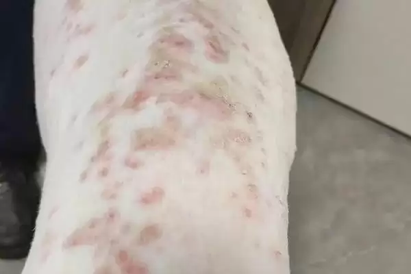 狗狗掉胡子是何原因,狗狗掉胡子是营养不足或遗传因素导致吗插图6 狗狗掉胡子是何原因,狗狗掉胡子是营养不足或遗传因素导致吗插图6