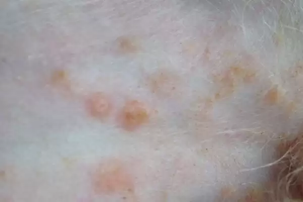 狗狗脓皮症反复咋解决,狗狗脓皮症需长时间用抗生素治疗吗插图6 狗狗脓皮症反复咋解决,狗狗脓皮症需长时间用抗生素治疗吗插图6