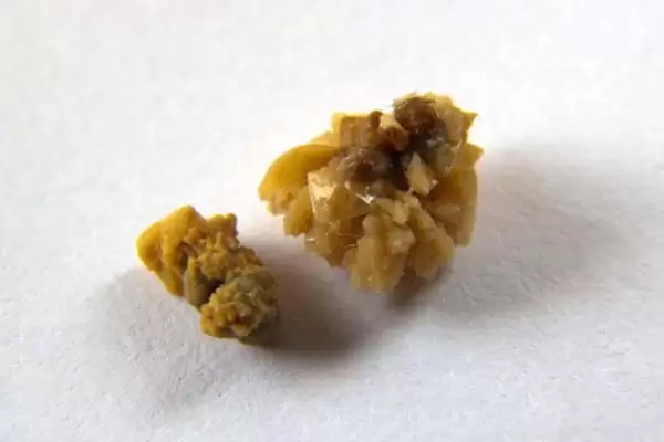 狗得了结石怎么解决,狗结石小且症状轻可药物治疗吗插图5