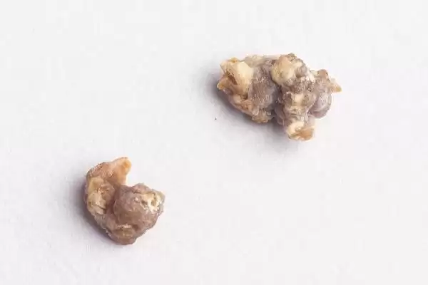 狗得了结石怎么解决,狗结石小且症状轻可药物治疗吗插图8