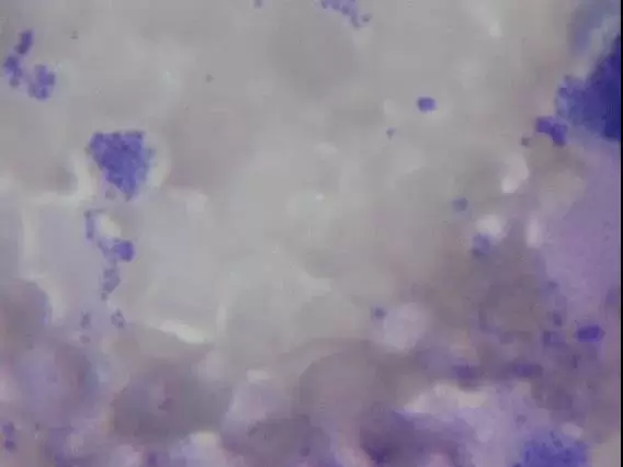 伊拉肉兔球虫继发葡萄球菌感染的诊治插图1 伊拉肉兔球虫继发葡萄球菌感染的诊治插图1
