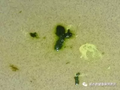 夏季鸽子拉的粪便代表什么症状,你知道吗?插图 夏季鸽子拉的粪便代表什么症状,你知道吗?插图