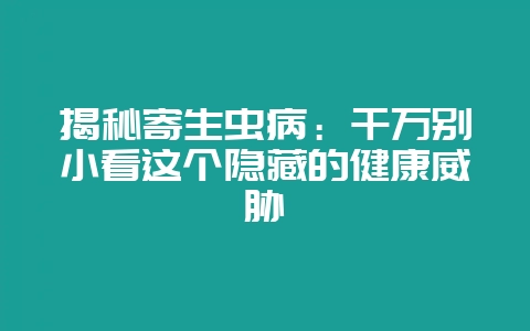 揭秘寄生虫病：千万别小看这个隐藏的健康威胁-会东网