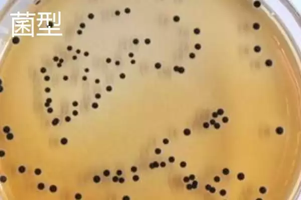 图片[6]-菌种的定义 ,菌种具体指的是什么微生物呢？-会东网