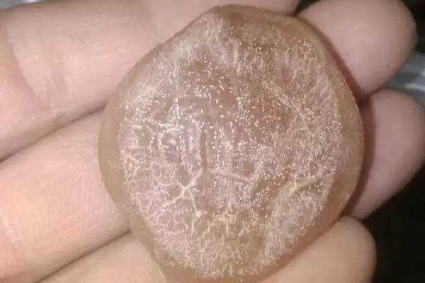 图片[3]-青鱼石位置探寻：在青鱼牙齿上方枕骨上的发现-会东网