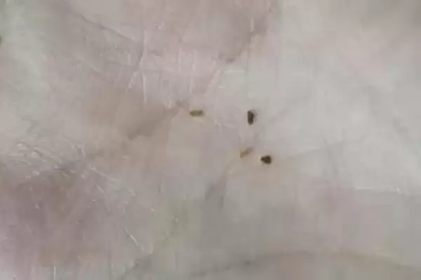 图片[3]-跳蚤的灭杀方法？灭杀跳蚤要掌握哪些有效的物理、化学和生物防治方法？-会东网
